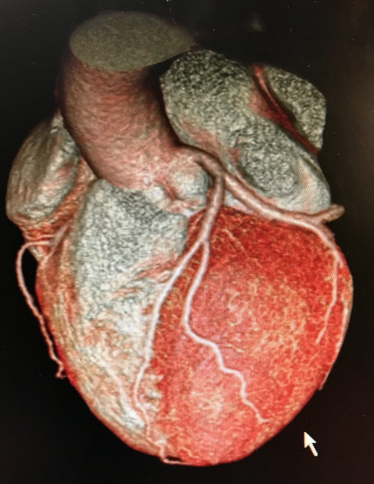 Cardiology Slide 1