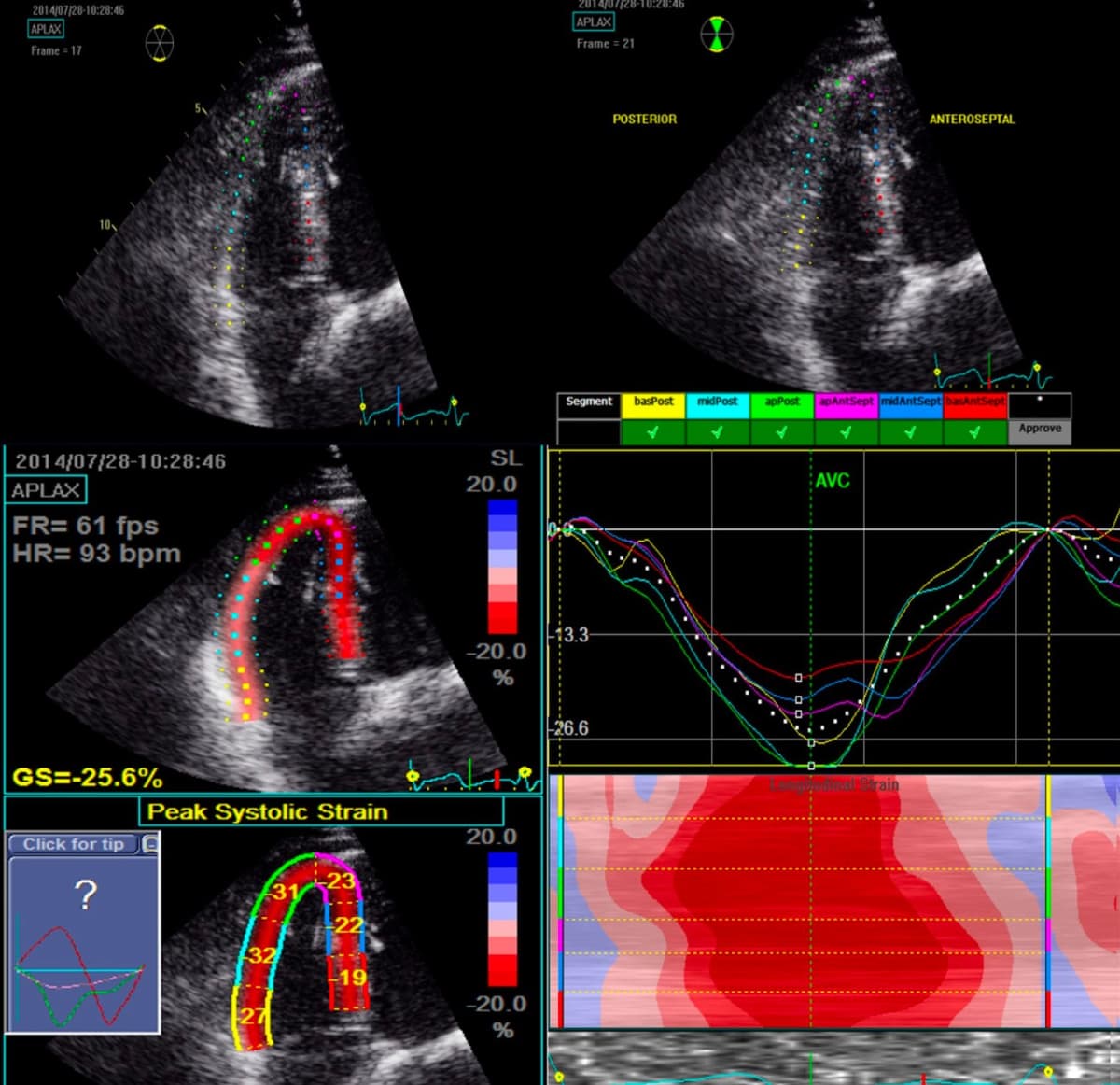 Cardiology Slide 3