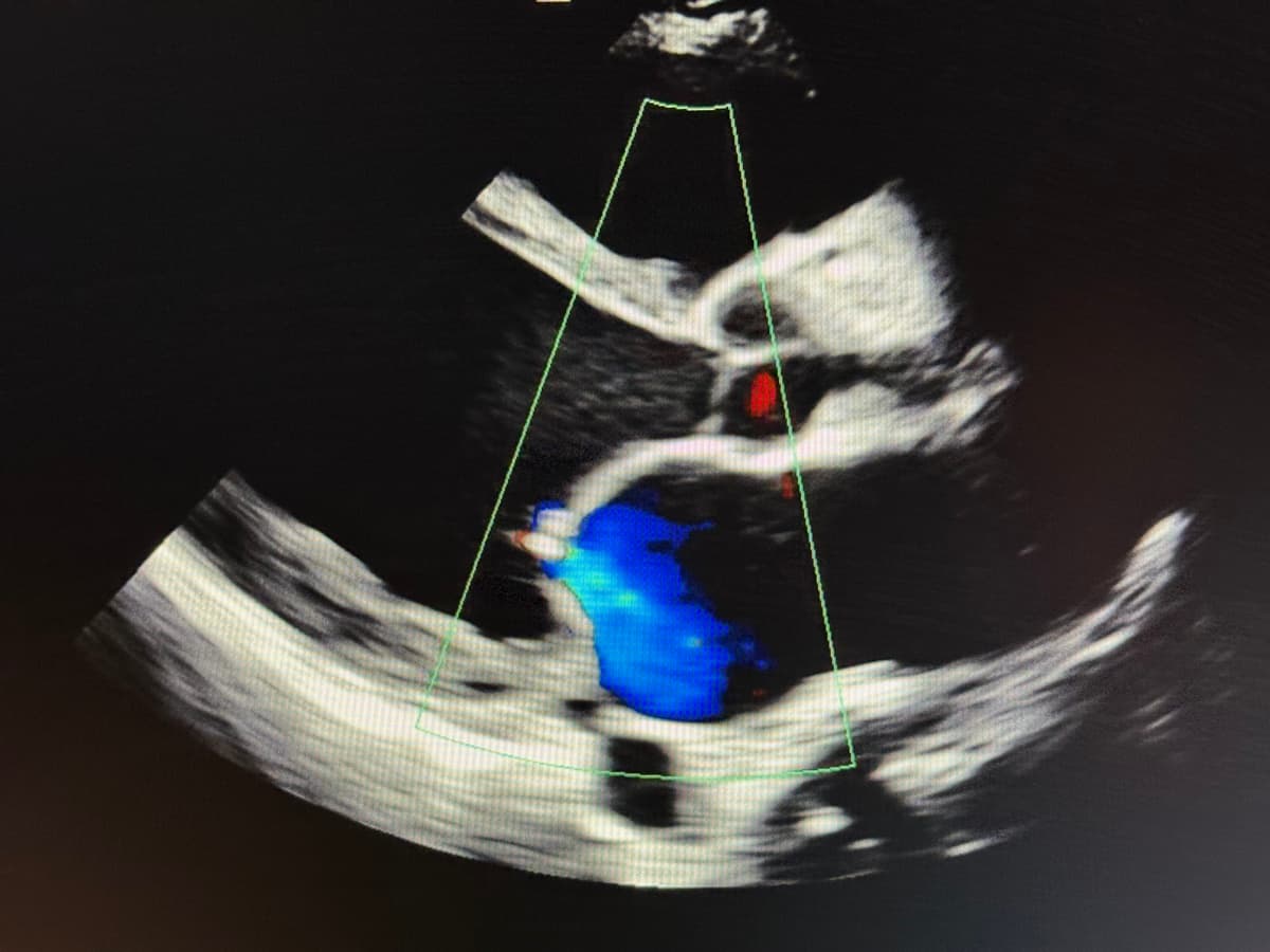 Cardiology Slide 4