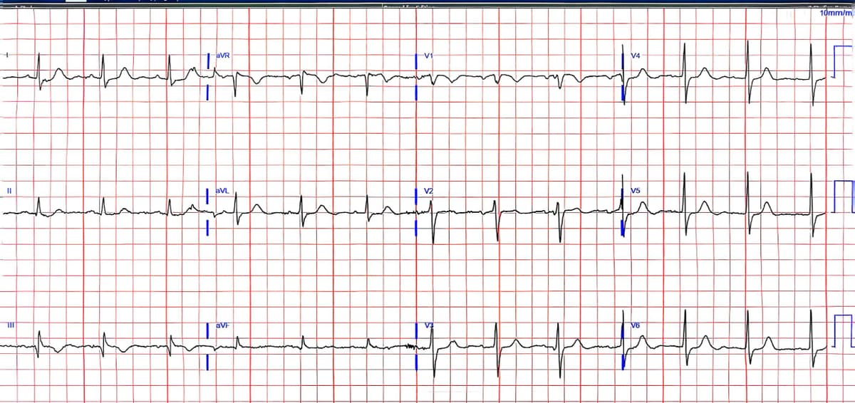 Cardiology Slide 5