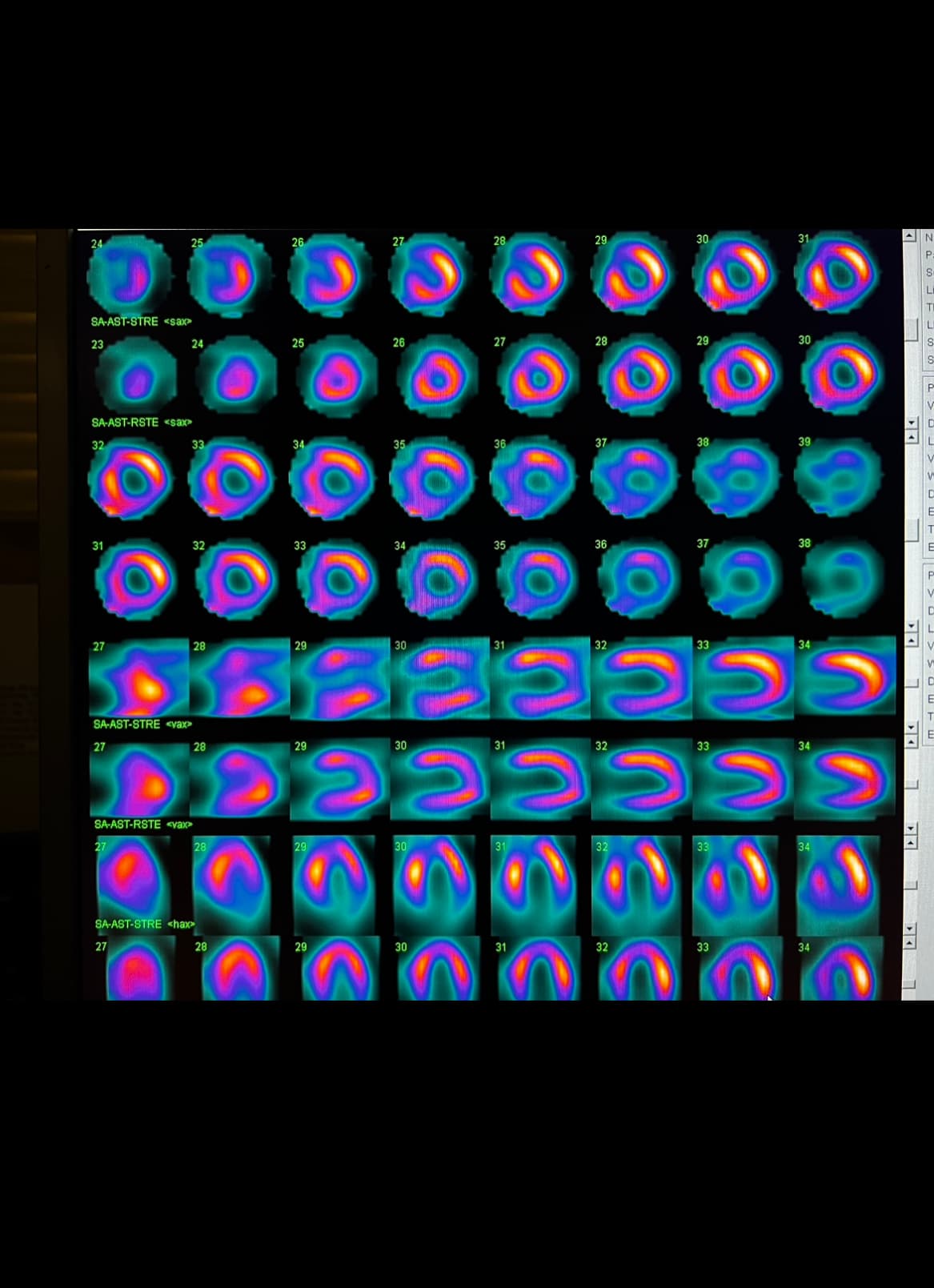 Cardiology Slide 6